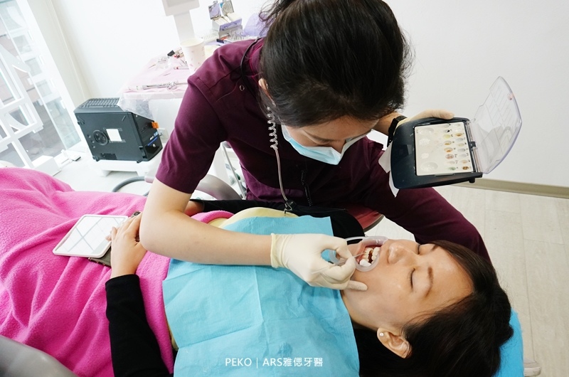 雅偲牙醫,台北牙醫推薦,台北牙醫診所,牙齒美白,冷光美白,全瓷冠,整牙,植牙推薦,台北植牙,經驗分享 @PEKO の Simple Life